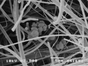 enzymefilter casestudy_03