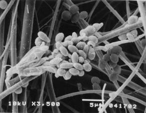 enzymefilter casestudy_05